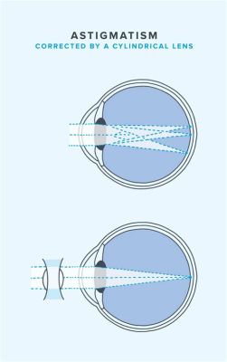 Are Contacts Plastic: A Dive into the Material World of Vision Correction