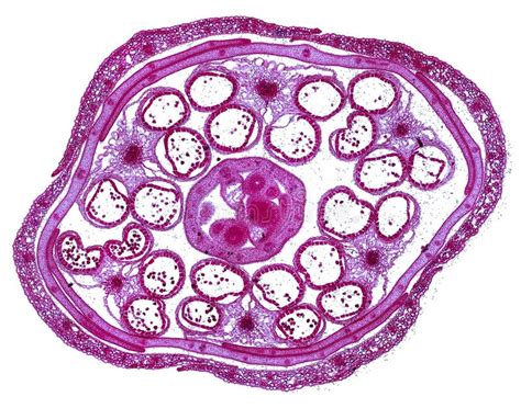  Breviata! Een Microscopische Wonderwereld van Vormende Amoeben