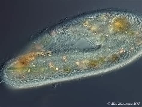  Chilodonella: Een microscopische zwemmer met een onophoudelijke honger!