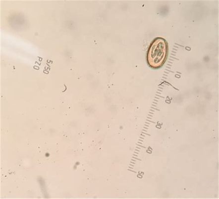  Eimeria! Een microscopisch schurkenrijk dat de darmen van dieren overneemt