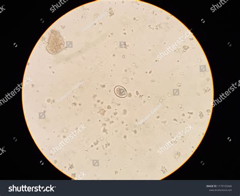  Isospora! Een Microscopische Wereldreiziger Met een Voorliefde voor Darmwand