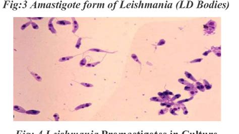  Leishmania: Een Microscopische Parasit Met een Verrassend Gevaarlijke Reis