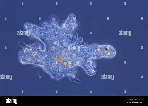  Rhizopoda! Een Amoeba met een Geheime Identiteit als Meester van Verandering